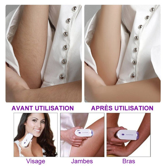 Épilateur Laser Portable Nelma™